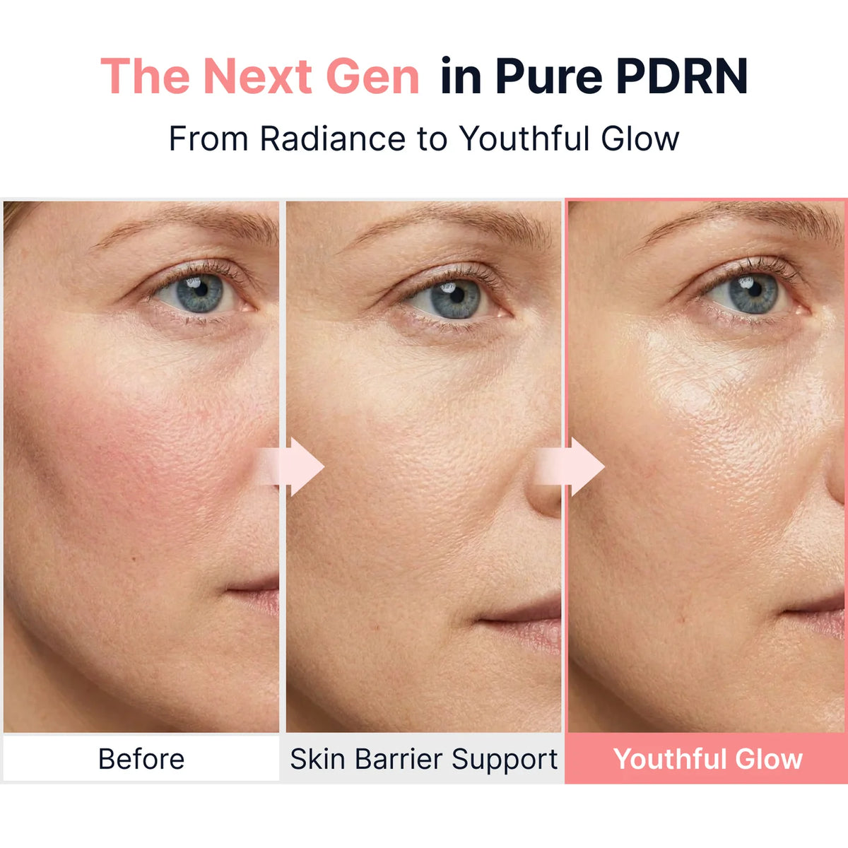 Silk Peptide Pink PDRN Glow Intensive Ampoule