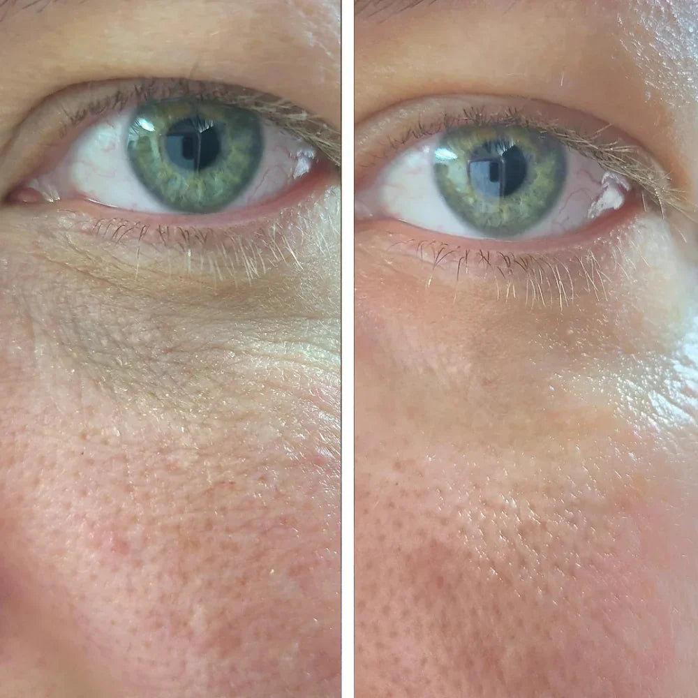 Divifit before after