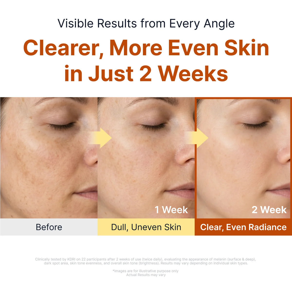Silk Peptide Kojic Acid Niacinamide Brightening Ampoule