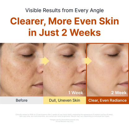 Silk Peptide Kojic Acid Niacinamide Brightening Ampoule